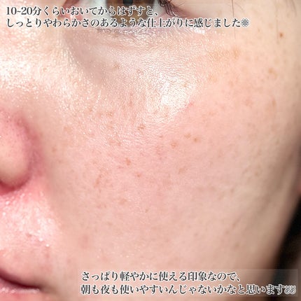 ブラックPDRN デイリーシートマスク/ネイチャーリパブリック/シートマスク・パックを使ったクチコミ(6枚目)