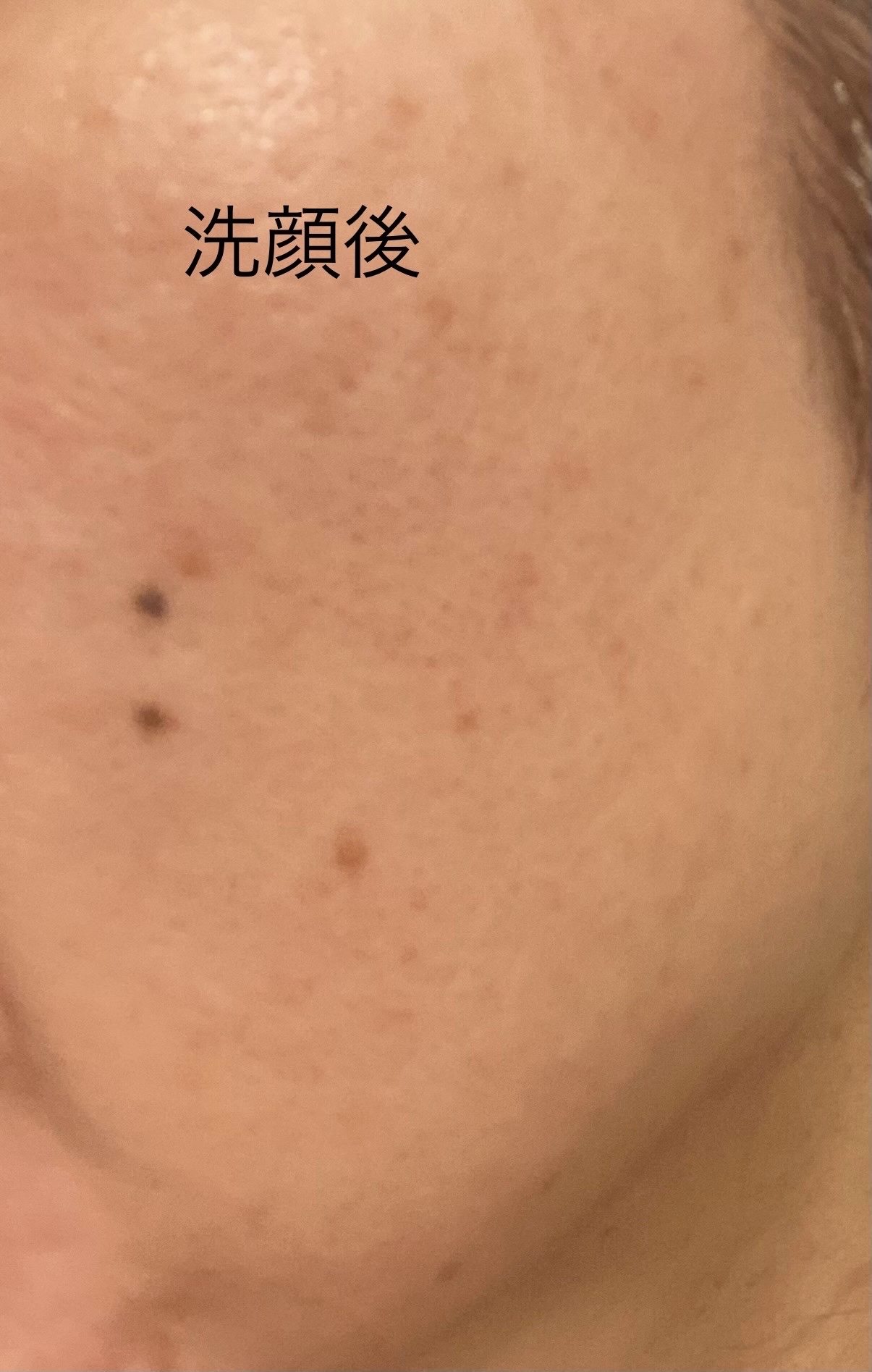 ビタトーニングセラムトナー/ダルバ/化粧水を使ったクチコミ（3枚目）