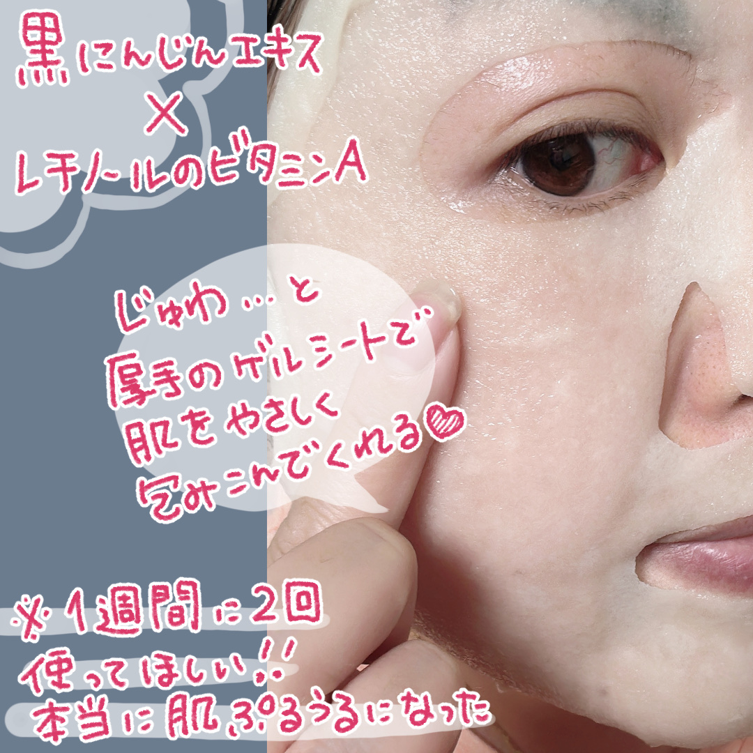 BLACK CARROT VITA-A RETINOL LIFTING GEL SHEET MASK/goodal/シートマスク・パックを使ったクチコミ（2枚目）