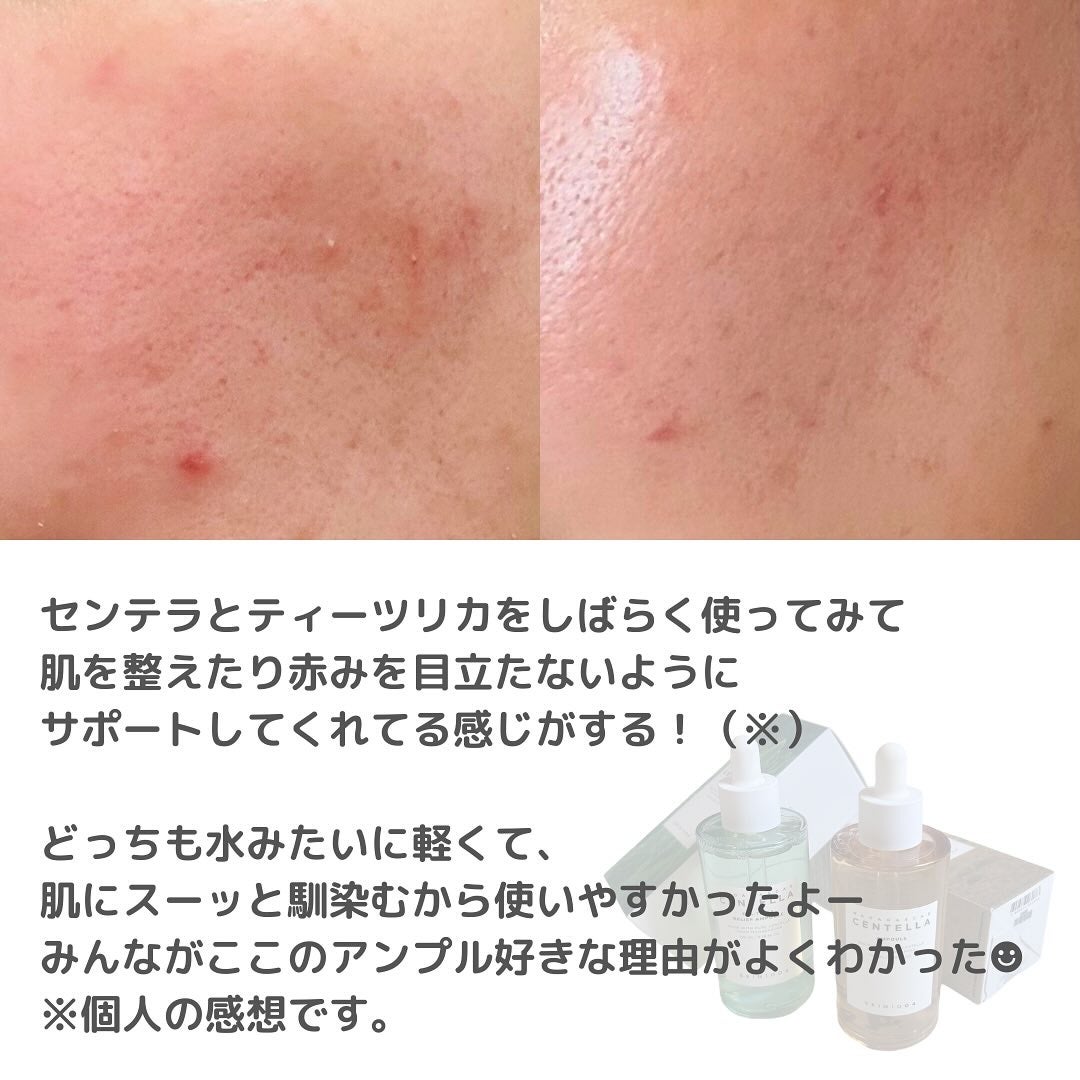 センテラ アンプル/SKIN1004/美容液を使ったクチコミ(4枚目)