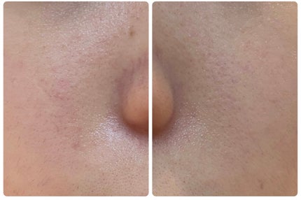 エターナルアイクリーム 8g/リュバンブラン/アイケア・アイクリームを使ったクチコミ(3枚目)