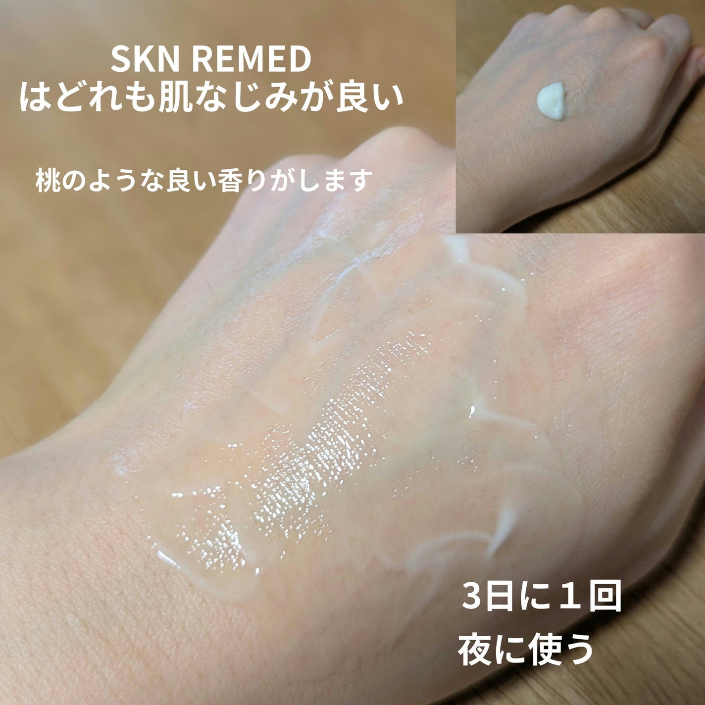 レチノダーマクリーム0.1/SKN REMED/フェイスクリームを使ったクチコミ(2枚目)