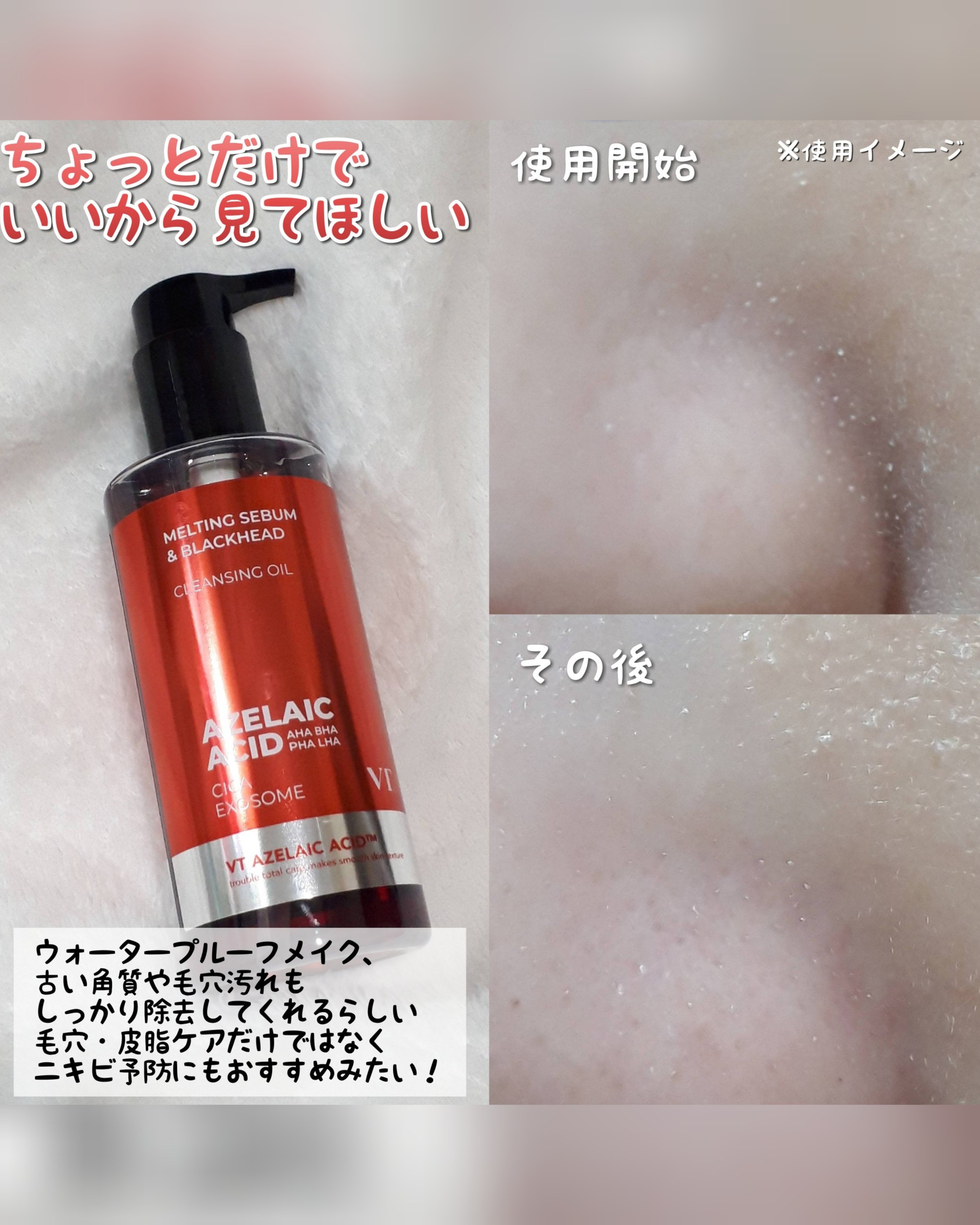 AZケア クレンジングオイル/VT/オイルクレンジングを使ったクチコミ（3枚目）