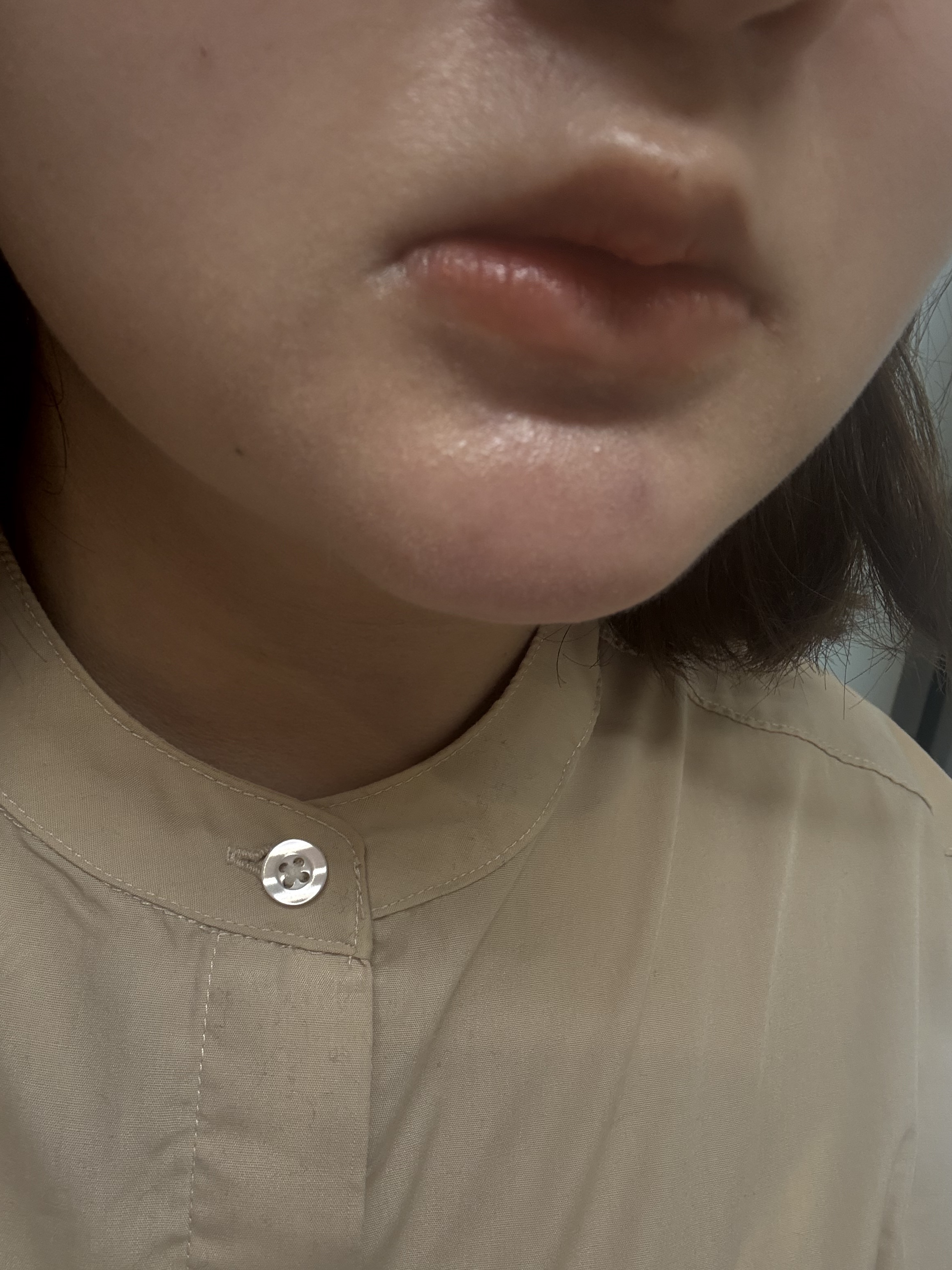 ロングラスティングチップコンシーラー/LUNA/リキッドコンシーラーを使ったクチコミ（1枚目）