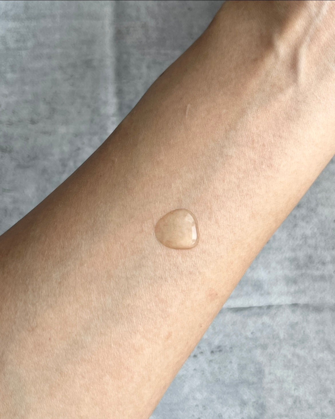 VC100エッセンスローション EX/ドクターシーラボⓇ/化粧水を使ったクチコミ(2枚目)