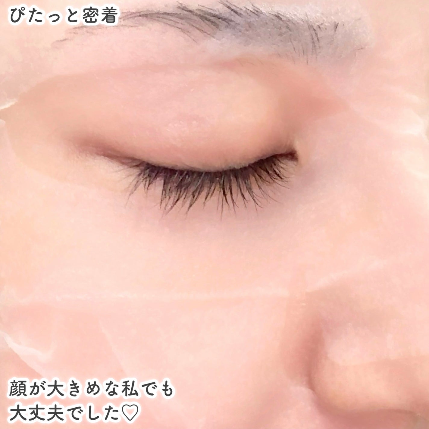 マデカッソシド ブレミッシュマスク/MEDIHEAL/シートマスク・パックを使ったクチコミ(4枚目)