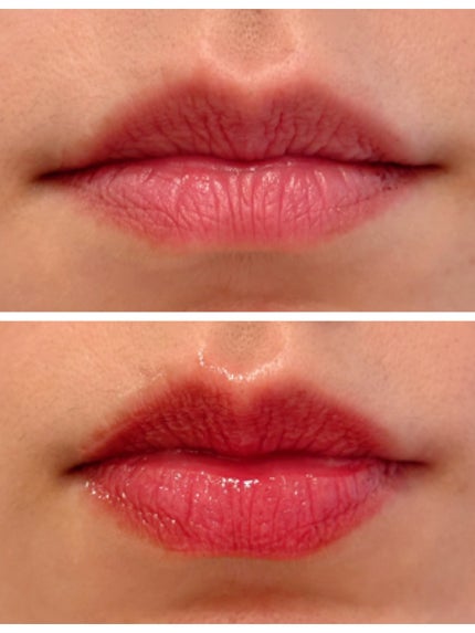 アルブラン リップセラムバーム/ALBLANC/リップバームを使ったクチコミ(3枚目)