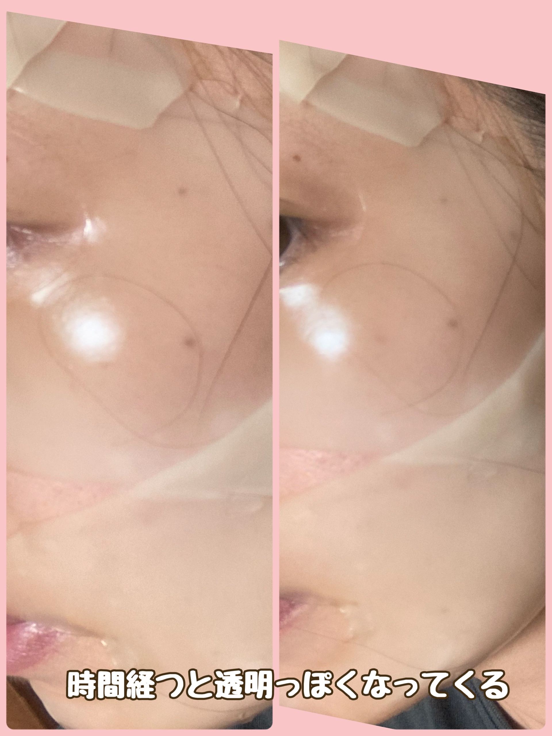 EGF アンプルコラーゲンマスク/BY ECOM/シートマスク・パックを使ったクチコミ（3枚目）