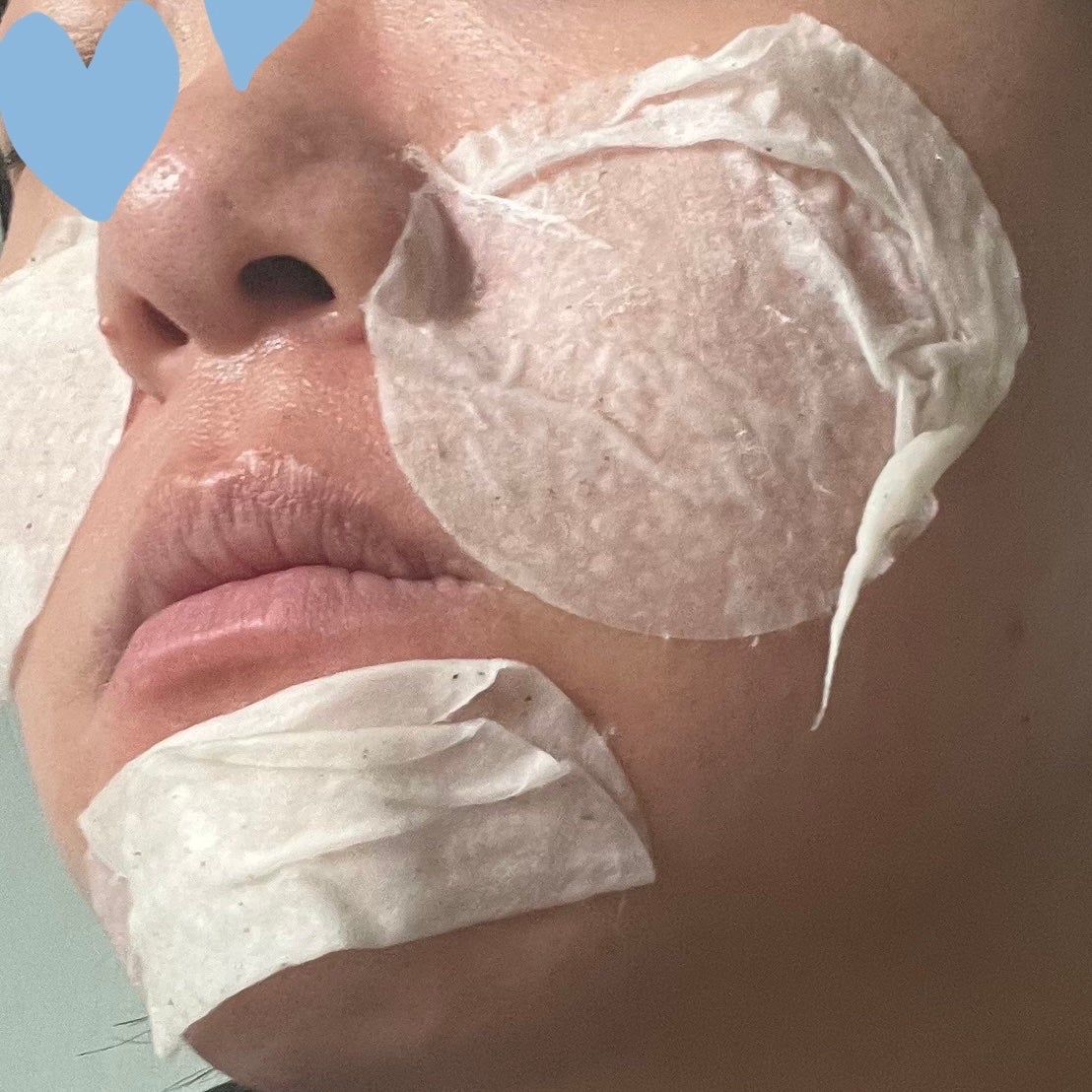 SKINFOOD ポテト マデカソ スージングパッド/SKINFOOD/トナーパッドを使ったクチコミ(1枚目)