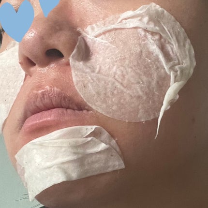 SKINFOOD ポテト マデカソ スージングパッド/SKINFOOD/トナーパッドを使ったクチコミ(1枚目)