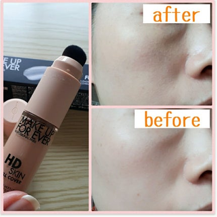 ディオールスキン フォーエヴァー スキン コレクト コンシーラー/Dior/リキッドコンシーラーを使ったクチコミ(6枚目)