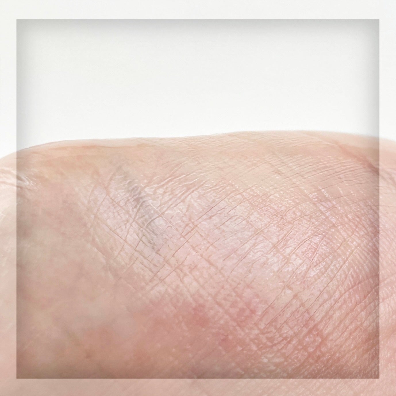 RXザ・アルファアルブチン2 ニキビ跡ケアセラム/COSRX/美容液を使ったクチコミ(5枚目)