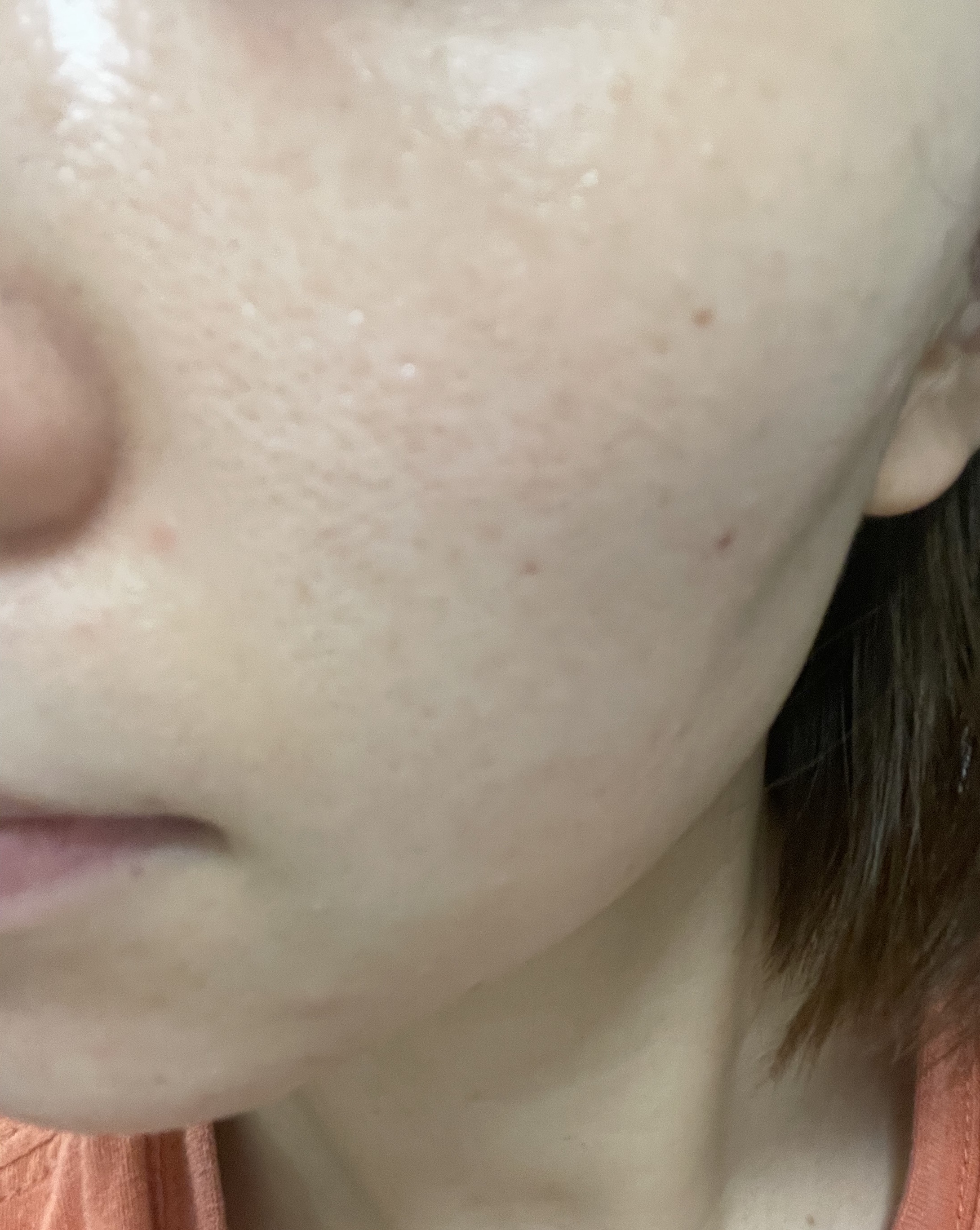 モイスチュア インストール/カルテHD/オールインワン化粧品を使ったクチコミ（1枚目）