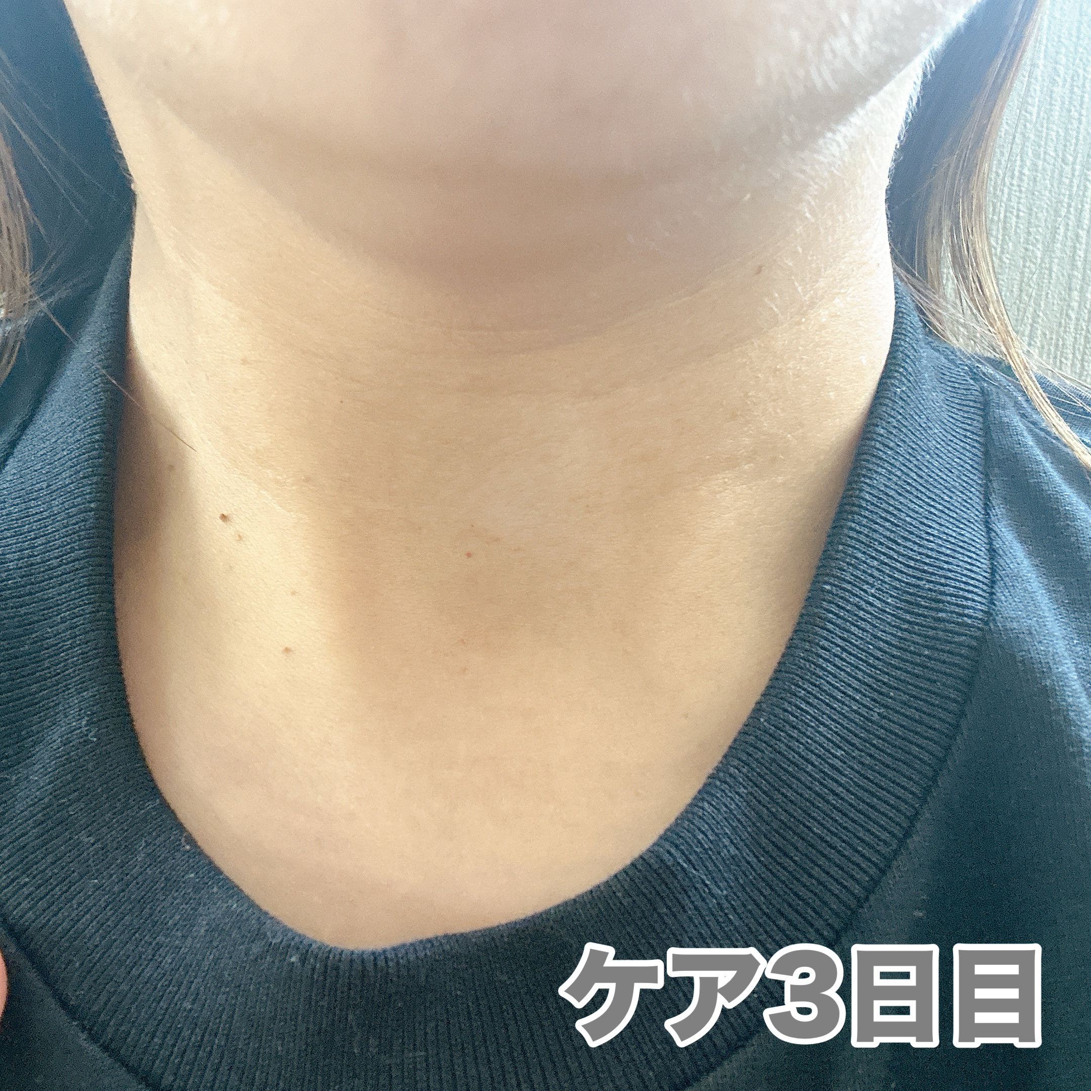 ウオーター/アベンヌ/ミスト状化粧水を使ったクチコミ（3枚目）