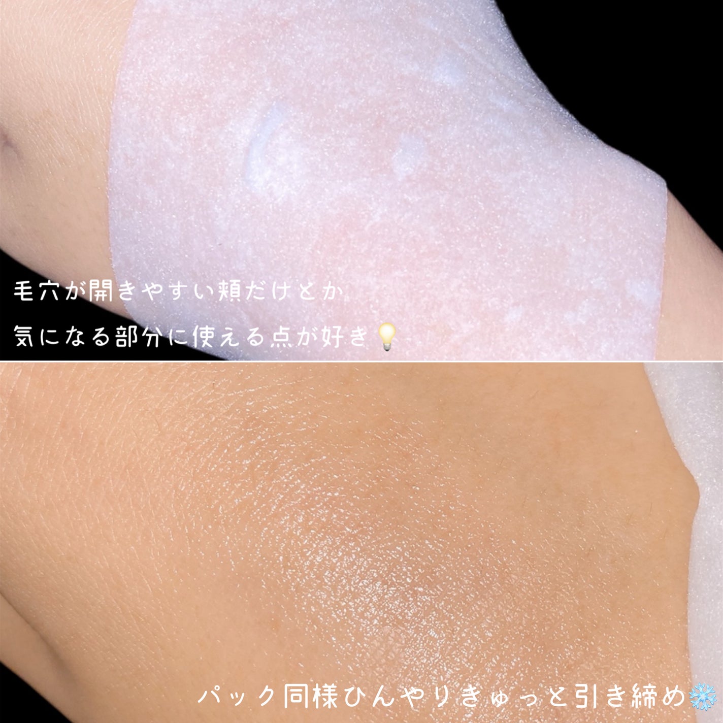 クライオひんやりスキンパック/VT/その他スキンケアを使ったクチコミ(5枚目)