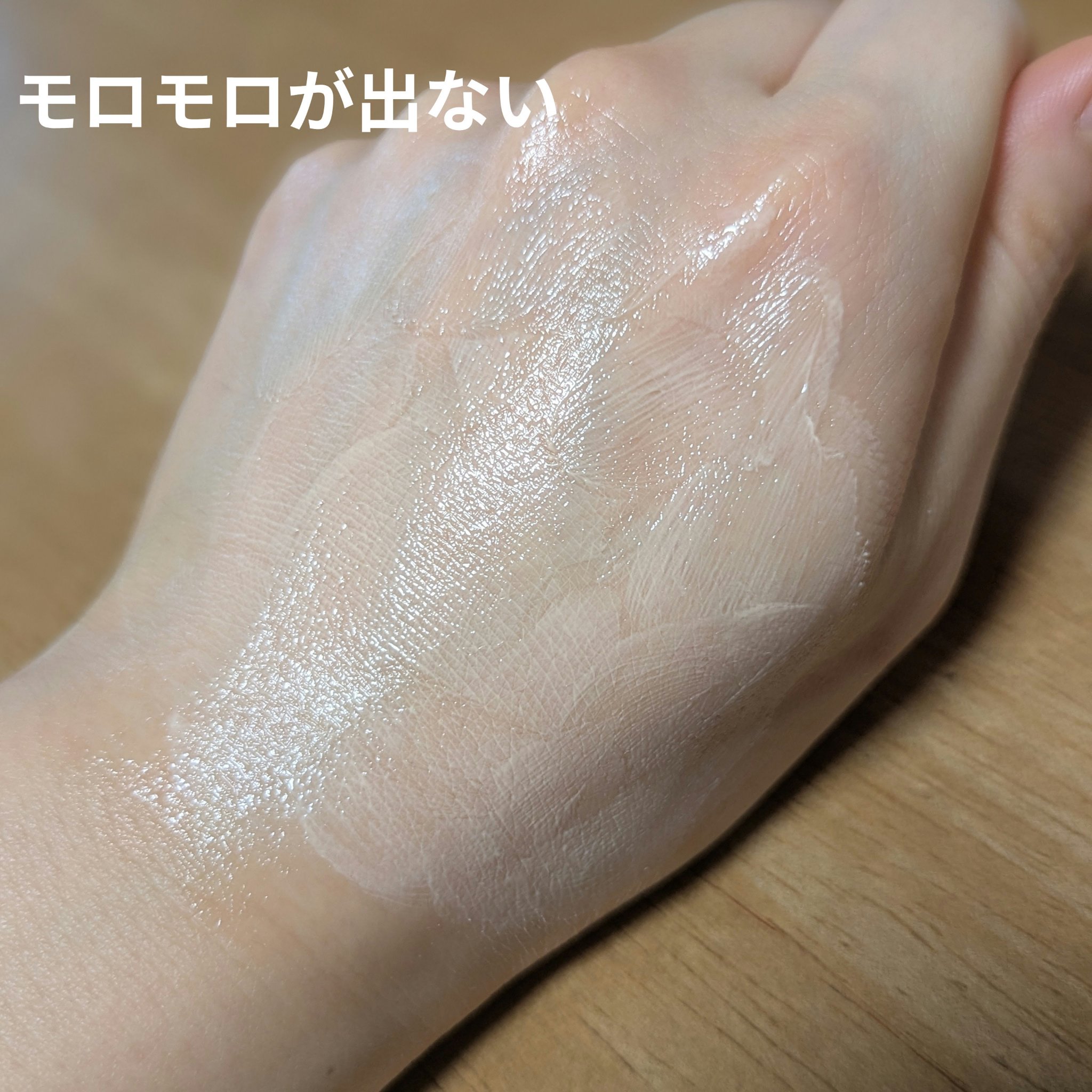 SKN REMED　薬用ナイアシナグロージェル/SKN REMED/フェイスクリームを使ったクチコミ（3枚目）