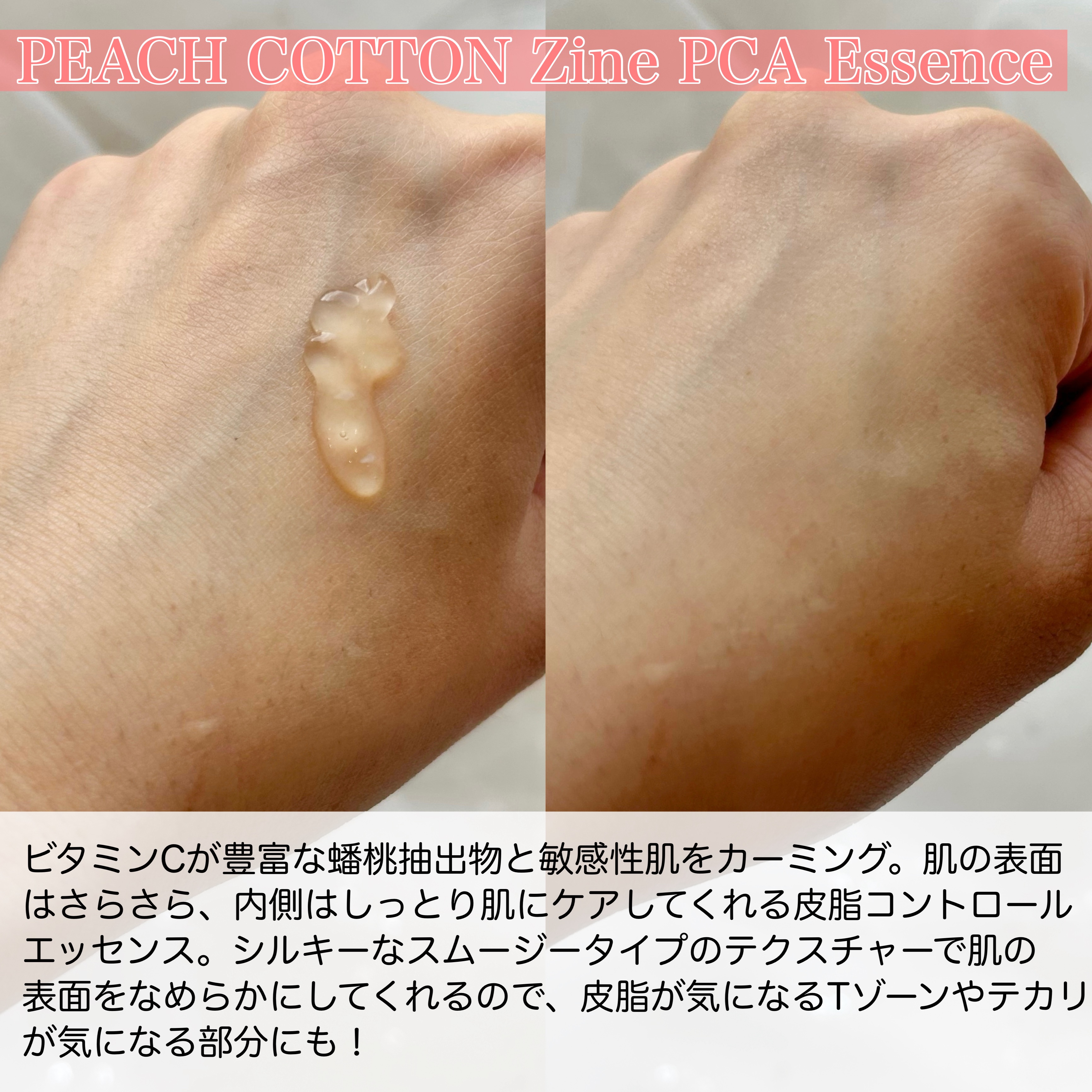 ピーチコットン ジンクPCAエッセンス/SKINFOOD/美容液を使ったクチコミ（3枚目）