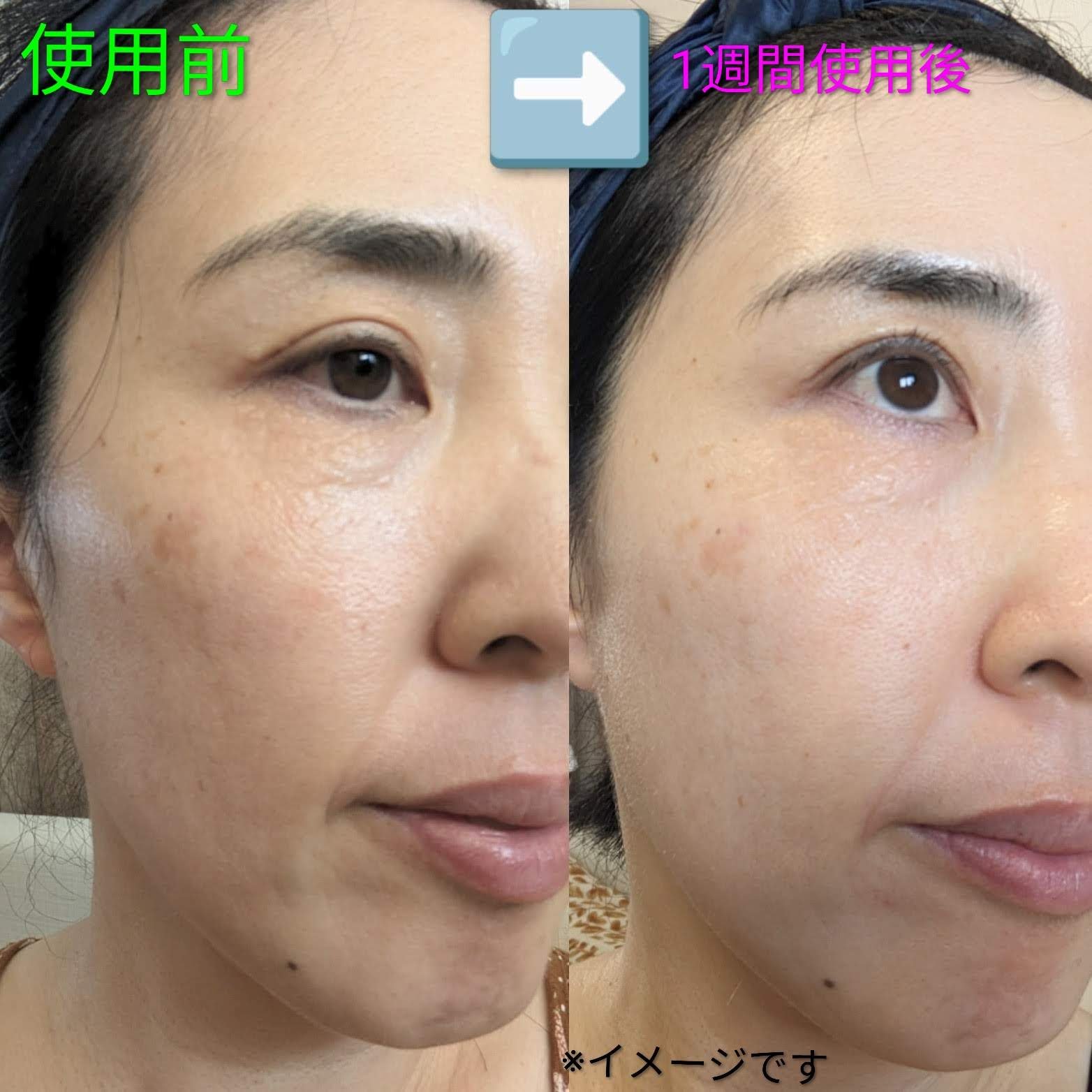 を使ったクチコミ（2枚目）