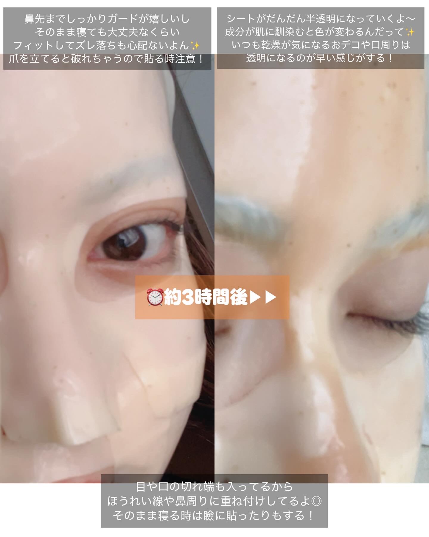 ライス70グロウコラーゲンマスク/Anua/シートマスク・パックを使ったクチコミ（2枚目）