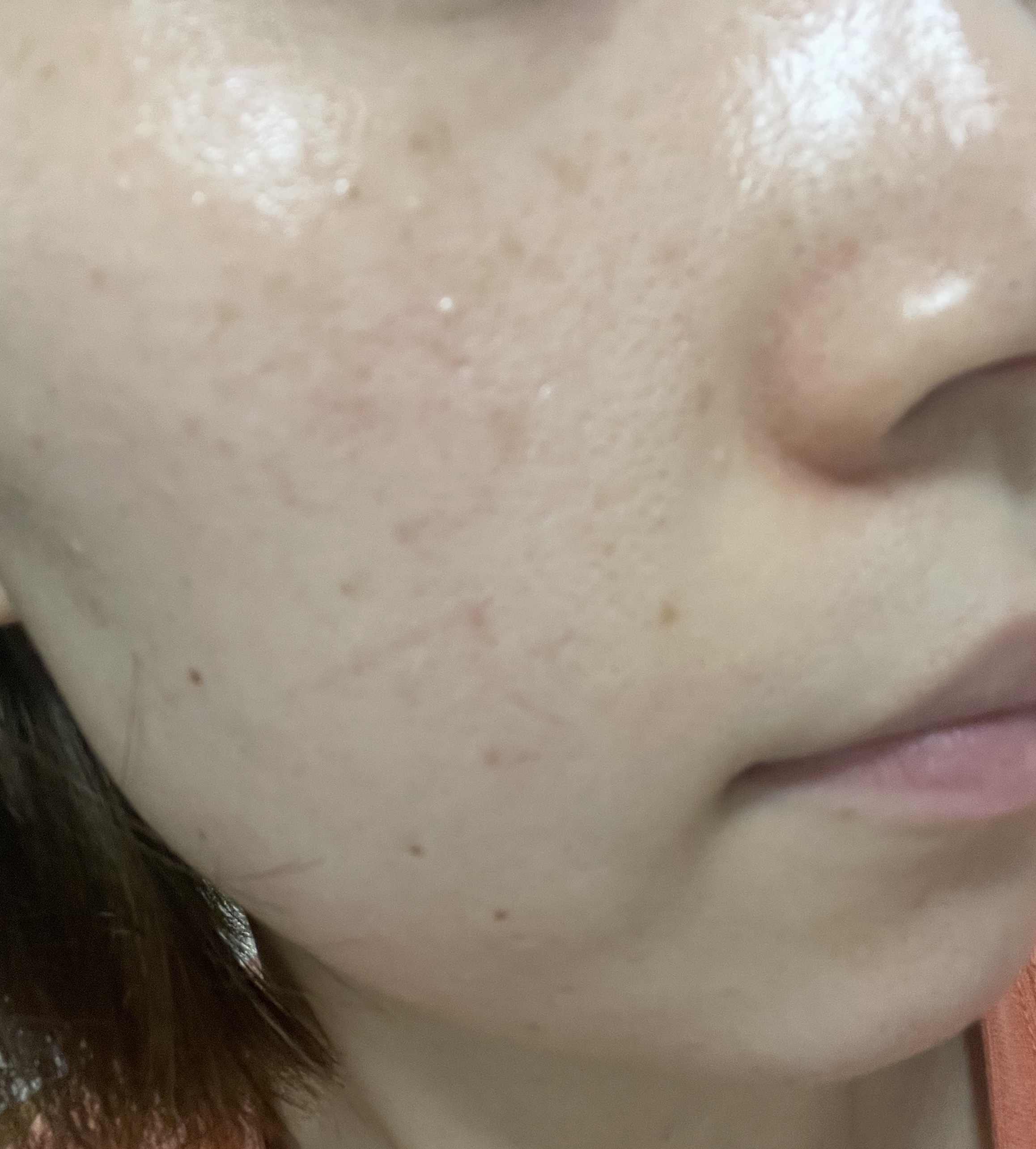 モイスチュア インストール/カルテHD/オールインワン化粧品を使ったクチコミ（2枚目）