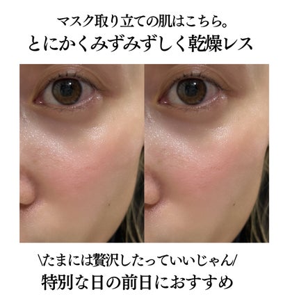 メラノショット W マスク/ONE BY KOSE/シートマスク・パックを使ったクチコミ(5枚目)