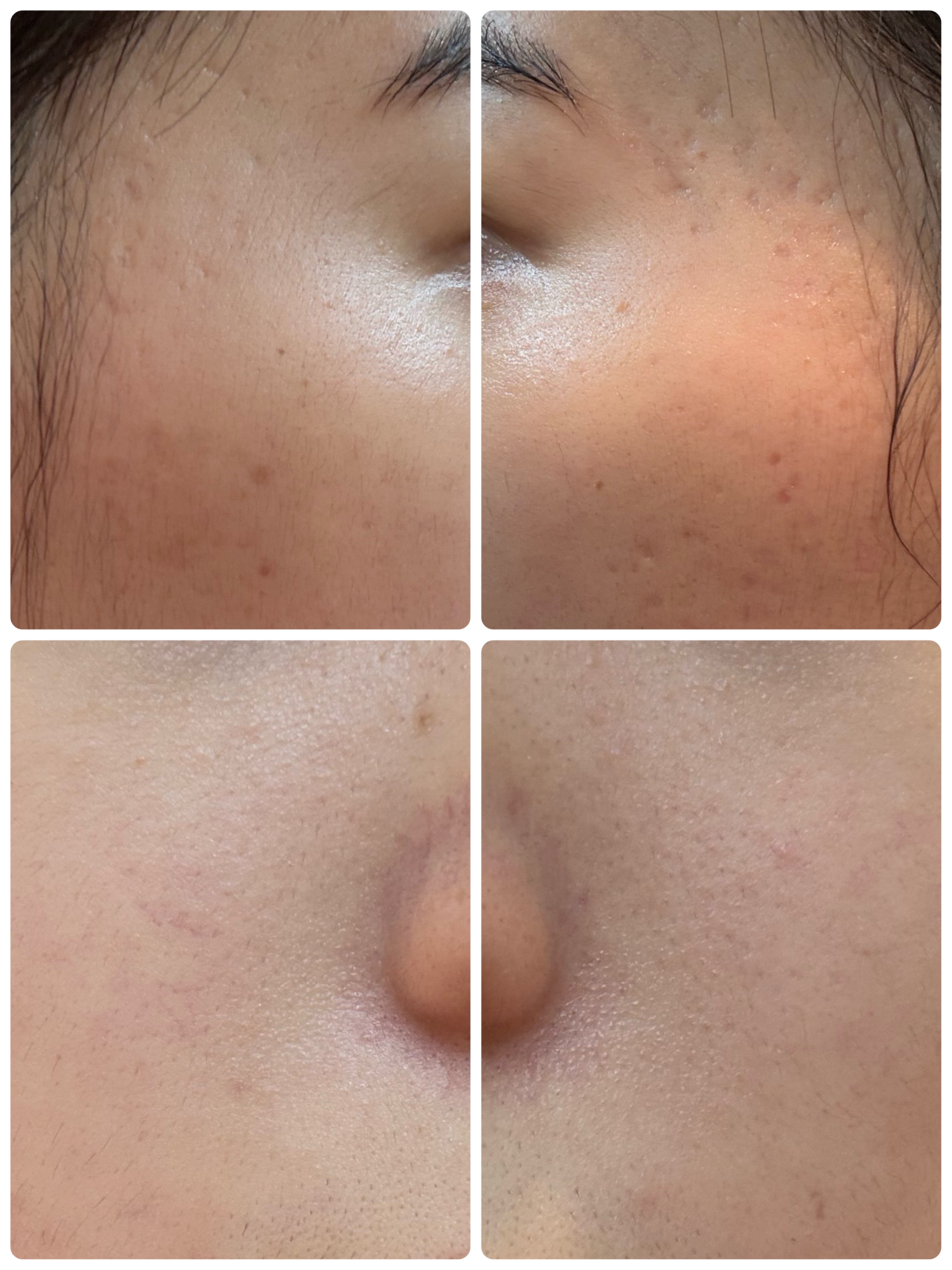 AGE-R ブースタープロ/MEDICUBE/美顔器・マッサージを使ったクチコミ（2枚目）