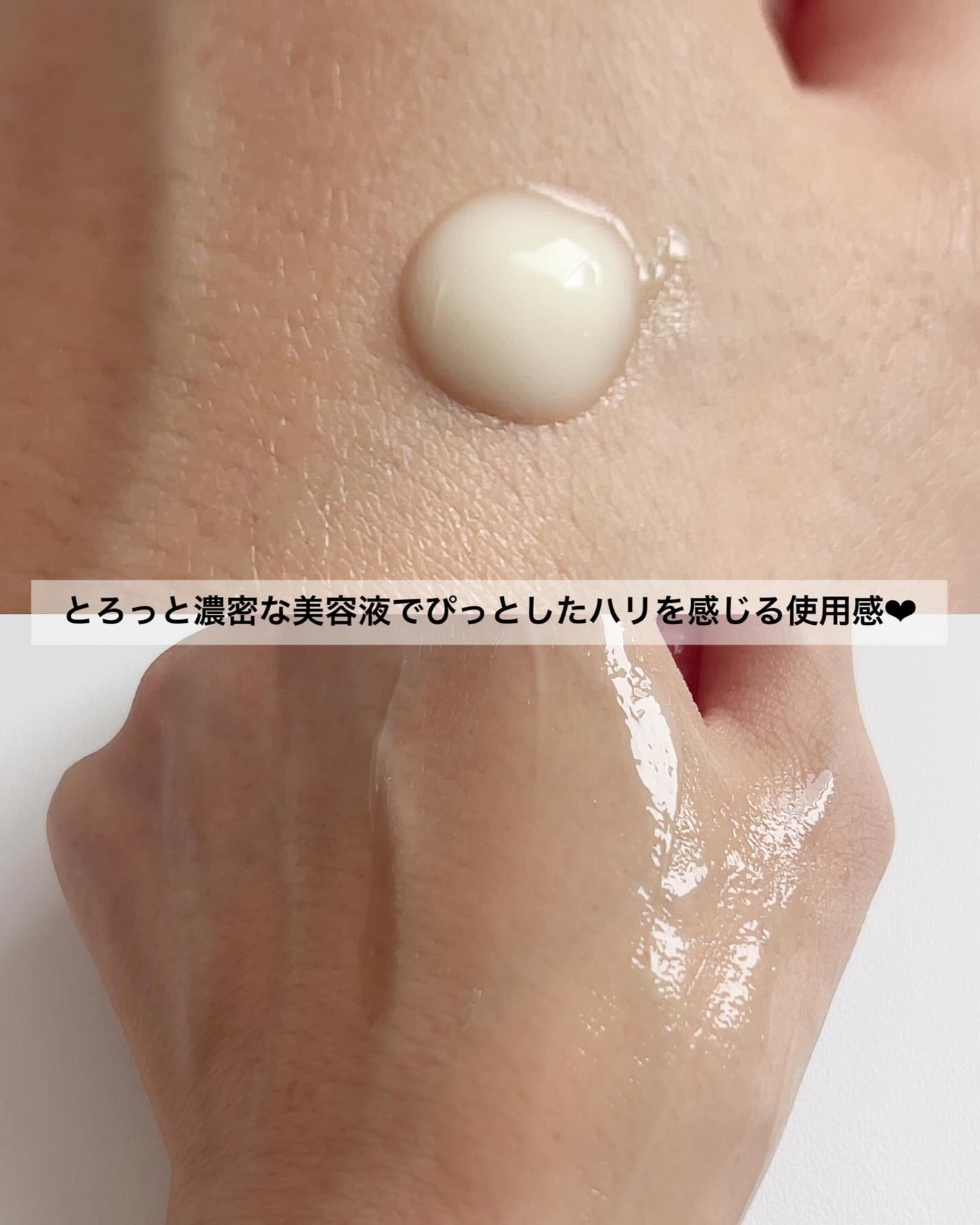 アットクリニックリンクルショットアンプル/DOMINAS/美容液を使ったクチコミ(3枚目)