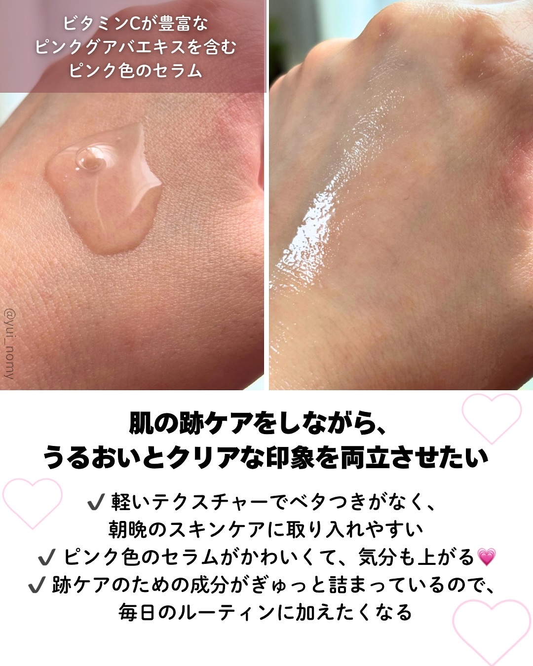 ビギンスバイジョンセンムルピンクGBセラム/BeginS by JUNGSAEMMOOL/美容液を使ったクチコミ（3枚目）