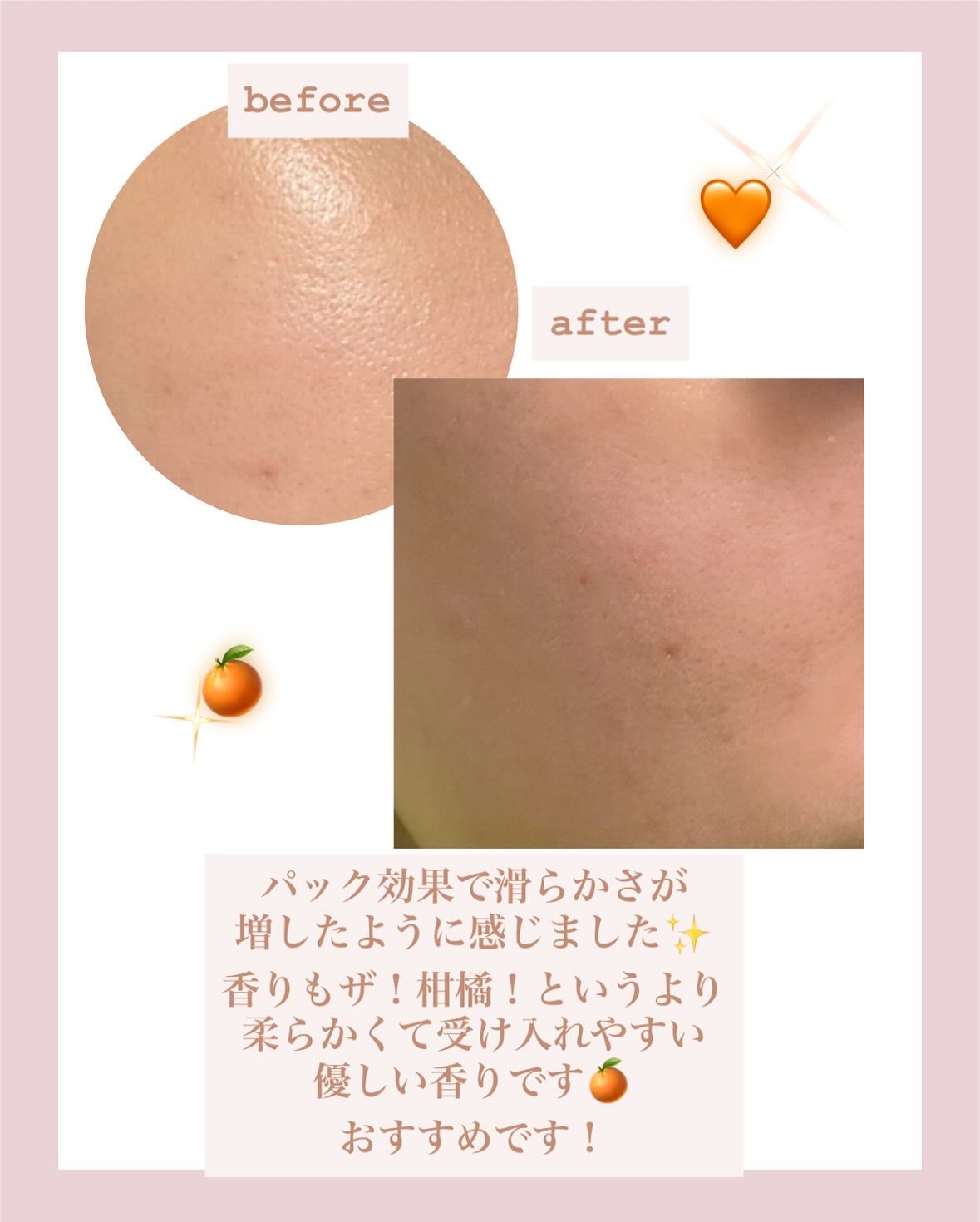 ヴィーガンパッククレンザーチューブ/WHIPPED/洗顔フォームを使ったクチコミ(3枚目)