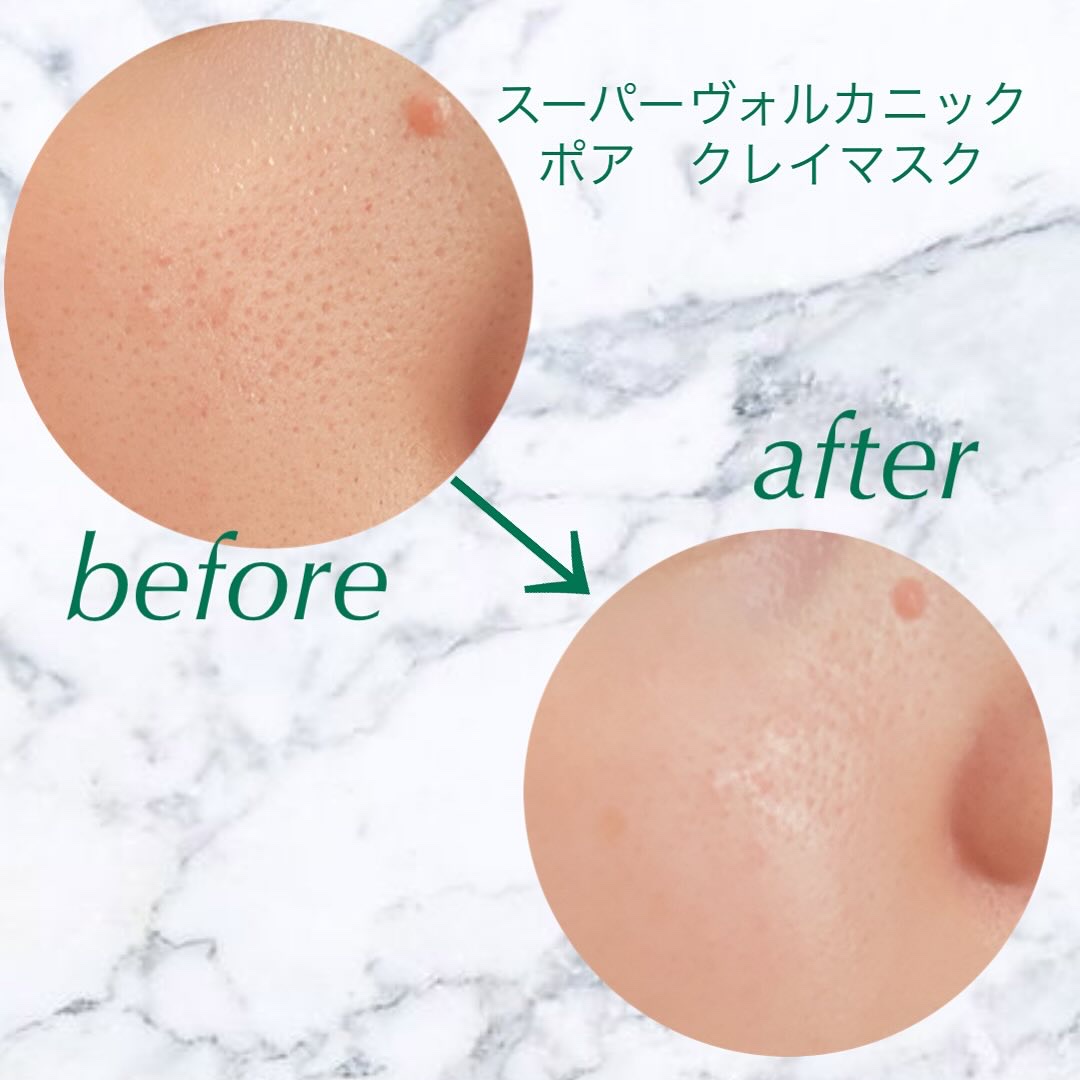 スーパーヴォルカニック　ポア　クレイマスク/innisfree/洗い流すパック・マスクを使ったクチコミ（3枚目）