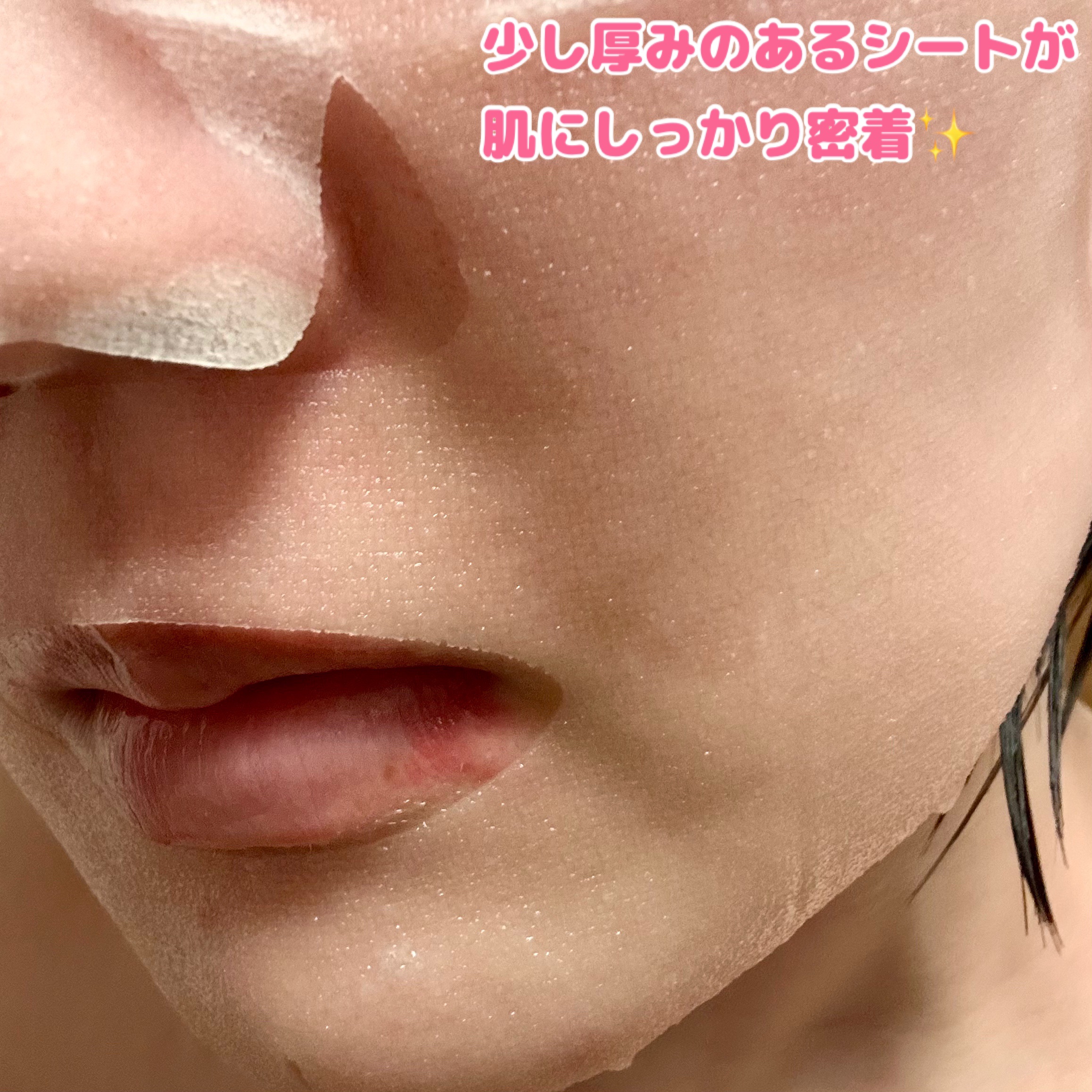 ごめんね素肌　いつのまにマスク/クリアターン/シートマスク・パックを使ったクチコミ（3枚目）