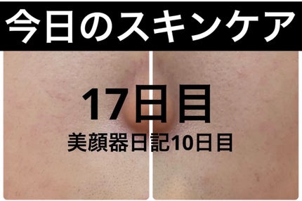 エターナルアイクリーム/リュバンブラン/アイケア・アイクリームを使ったクチコミ(1枚目)