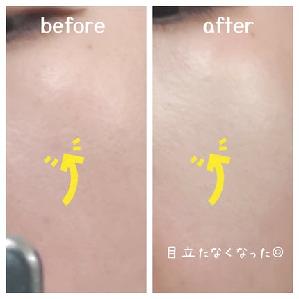 ロングラスティングチップコンシーラー/LUNA/リキッドコンシーラーを使ったクチコミ(5枚目)