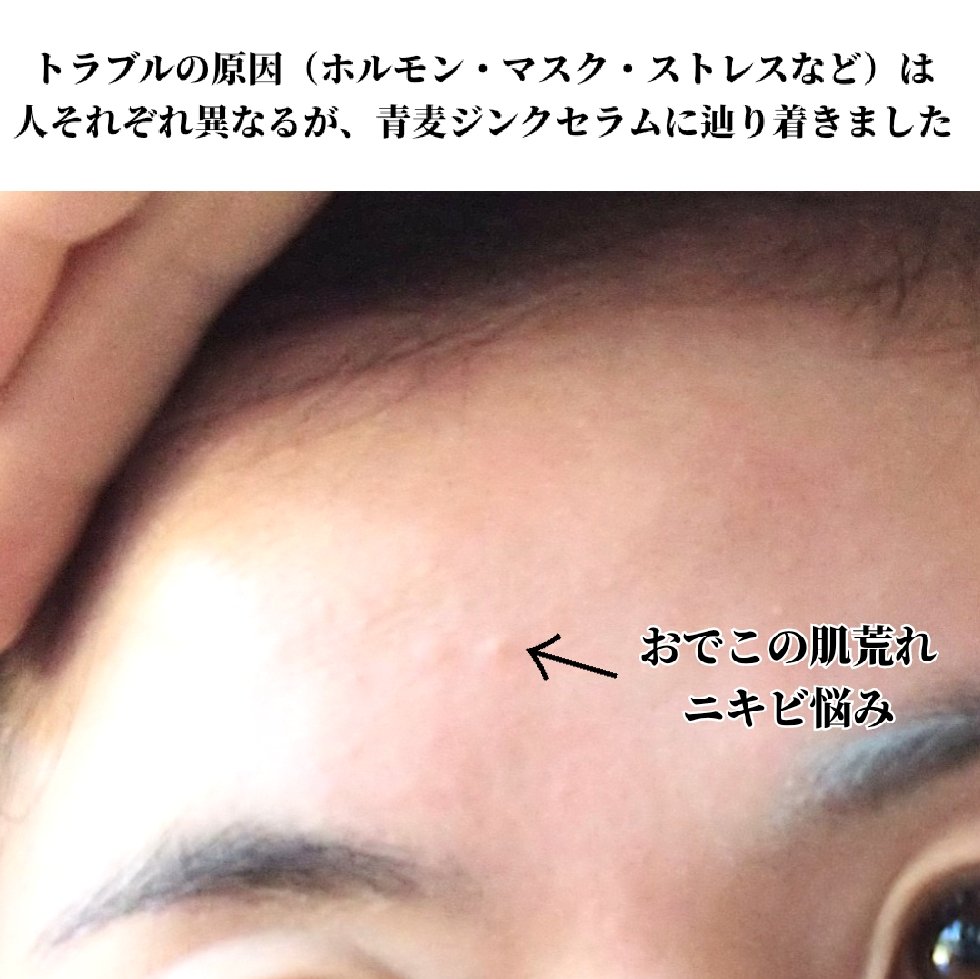 青麦ジンクセラム/Veganifect/美容液を使ったクチコミ（2枚目）