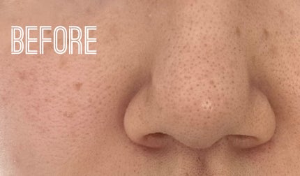 エテュセ スキンケアパウダー (プレスト)/ettusais/プレストパウダーを使ったクチコミ(5枚目)