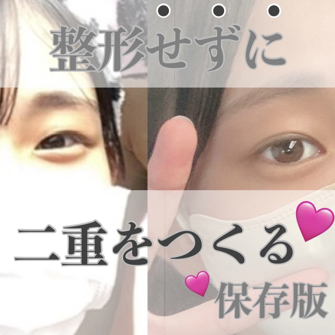 理想のふたえ きれいなライン/セリア/二重まぶた用アイテムを使ったクチコミ（1枚目）