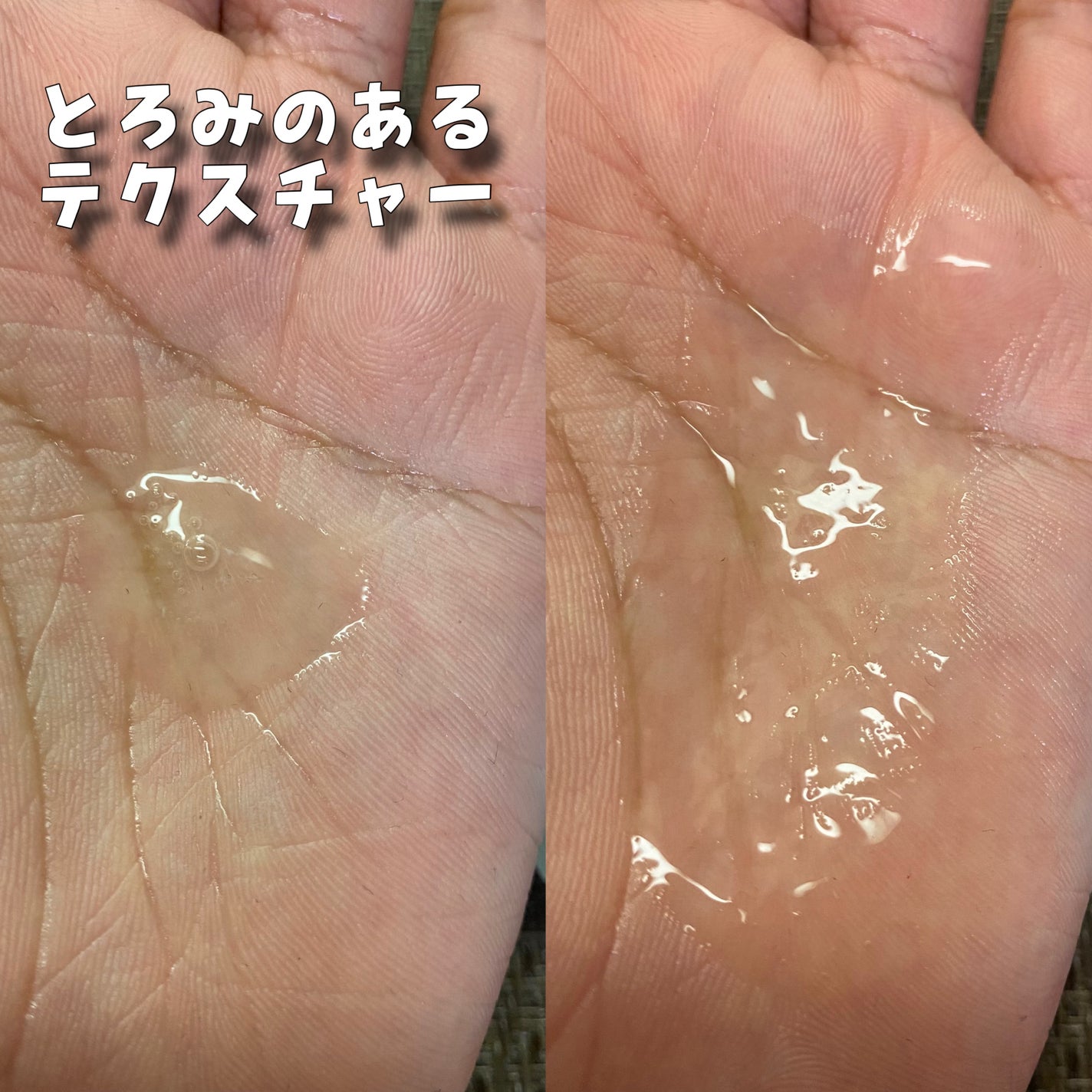 ビタセラム/AQUA MARE/美容液を使ったクチコミ(5枚目)