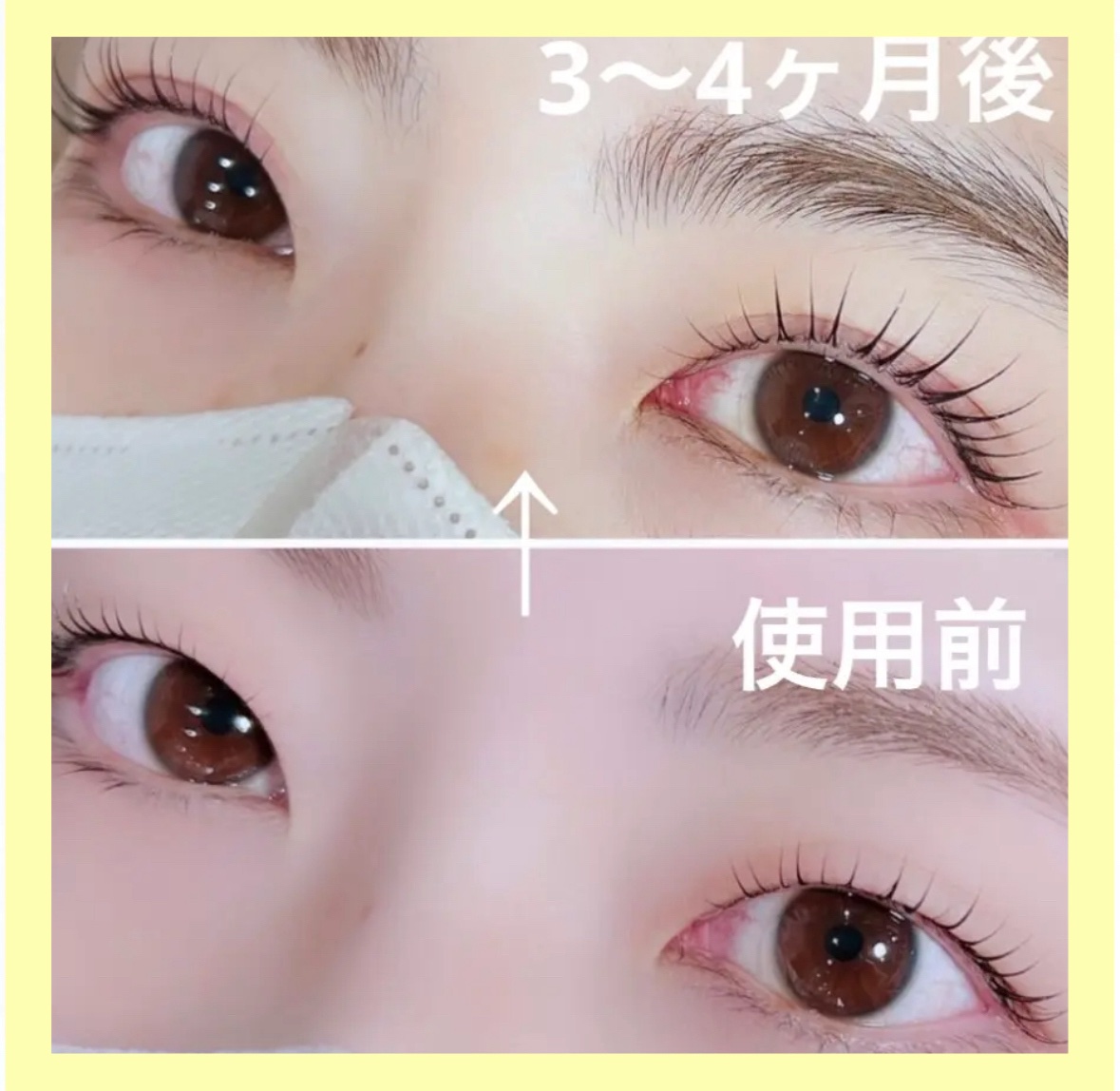 ラッシュアディクト アイラッシュコンディショニングセラム/soaddicted/まつげ美容液を使ったクチコミ（1枚目）