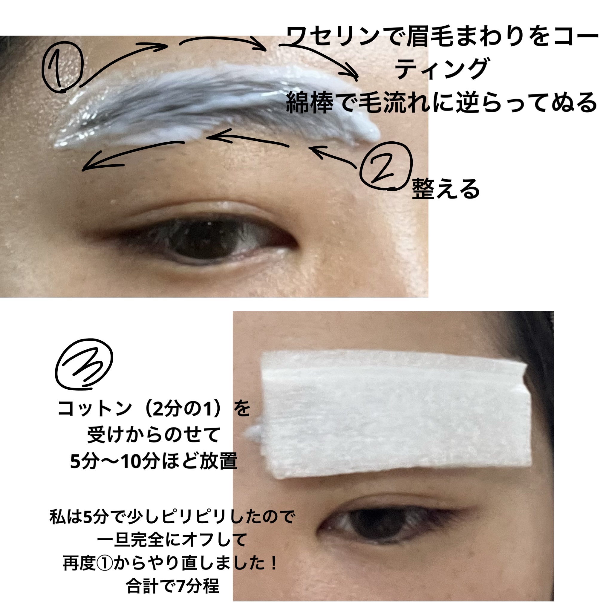 脱色クリーム 敏感肌用 55g＋55g/エピラット/ムダ毛ケアを使ったクチコミ（2枚目）