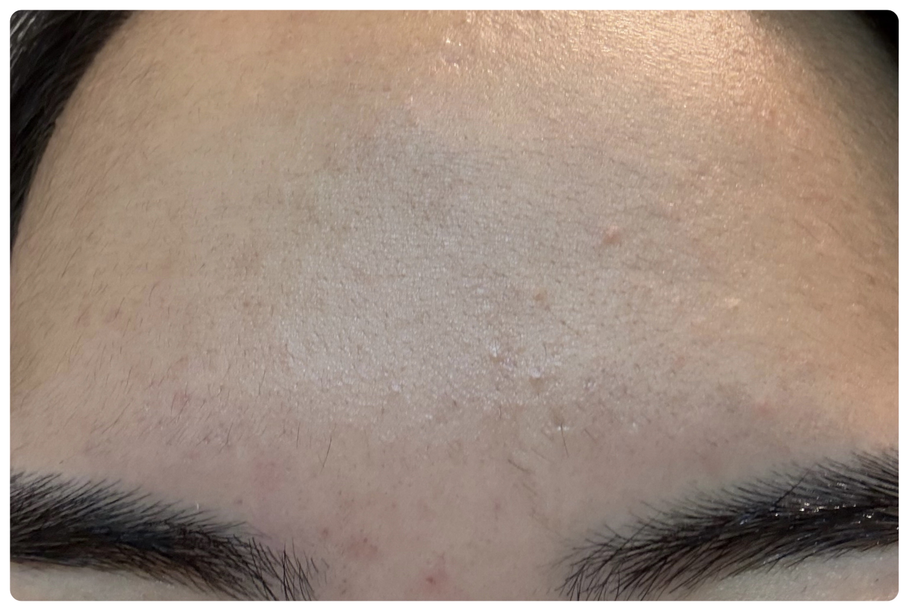 AGE-R ブースタープロ/MEDICUBE/美顔器・マッサージを使ったクチコミ（3枚目）