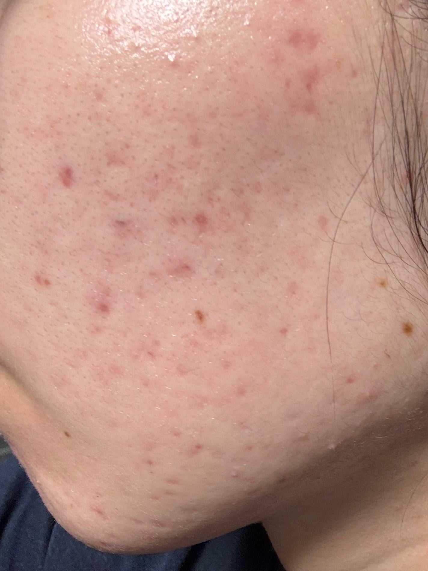 ãããð on LIPS ãããŒããã³2åç®ã¡ããã¡ãããããã§ããŠãð
..ãïŒ2æç®ïŒ