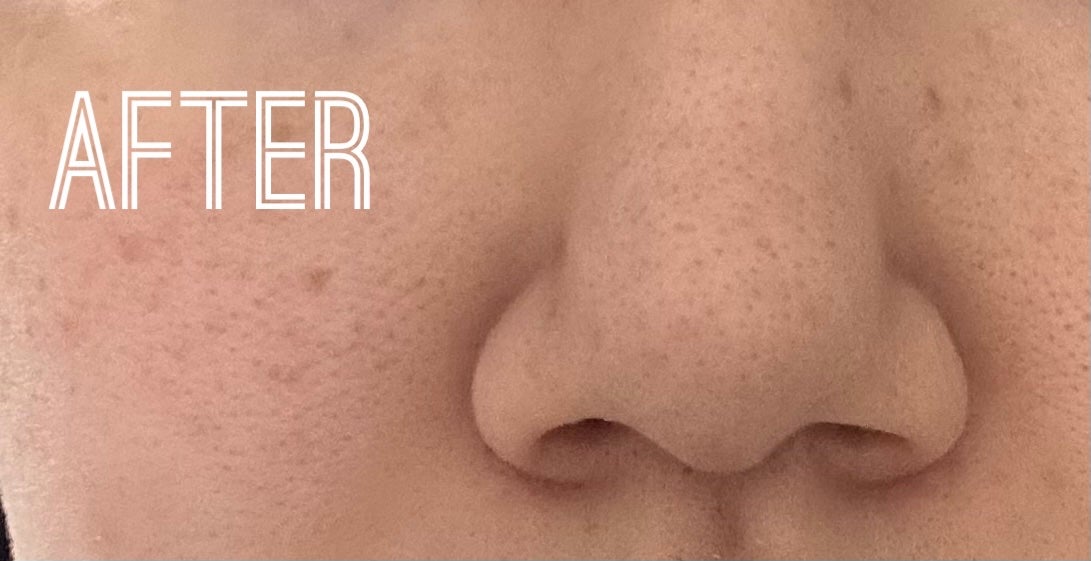 エテュセ スキンケアパウダー (プレスト)/ettusais/プレストパウダーを使ったクチコミ(6枚目)