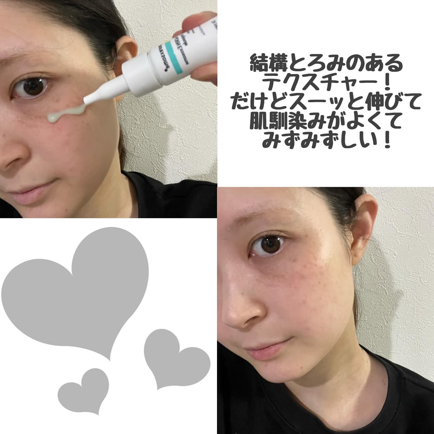 ReDRNエクソソームアンプル/Dr.nineteen/美容液を使ったクチコミ（2枚目）