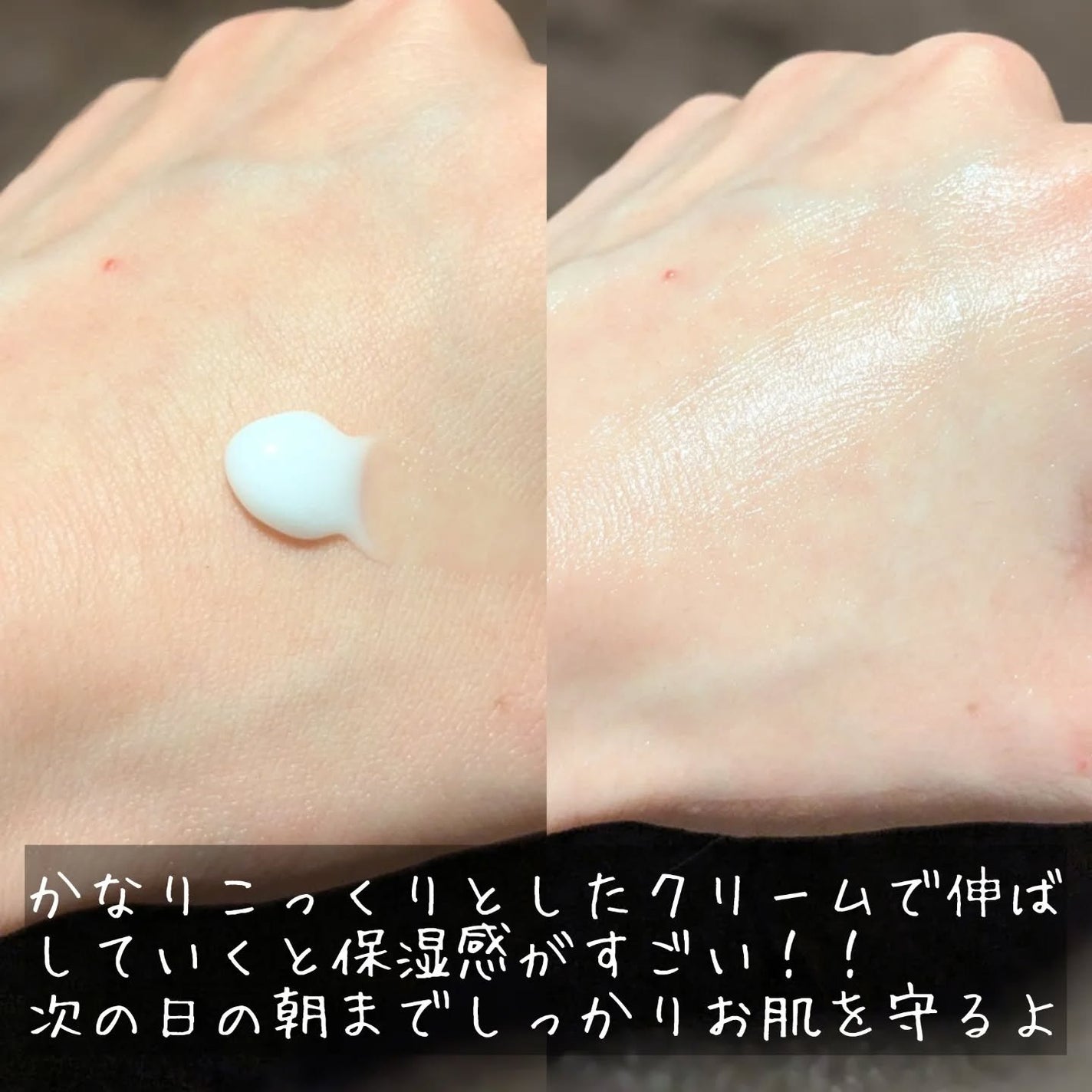 ペプチドボリュームマスタートナー/DR.PEPTI/ブースター・導入液を使ったクチコミ(6枚目)