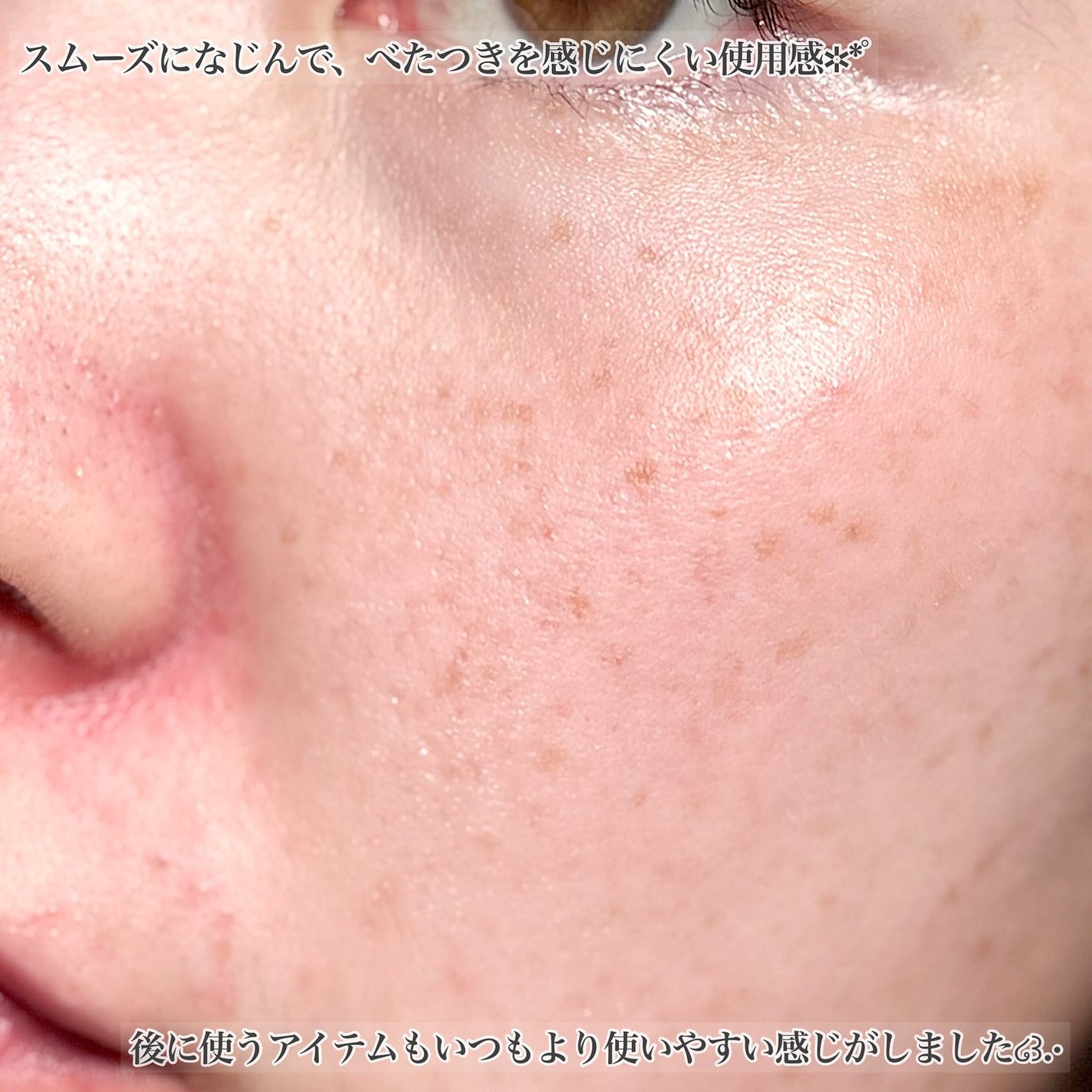 マイバイオーム ラクト ブースター/MAISON LEXIA/美容液を使ったクチコミ(5枚目)