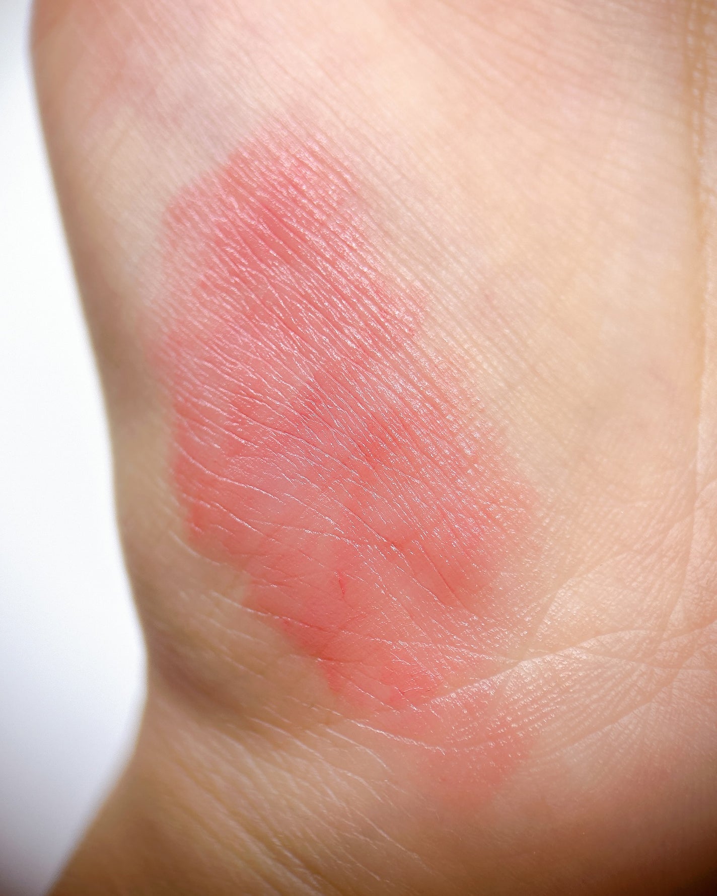 ãããðãã©ãã on LIPS ãã¹ãã³ã·ãŒãªãã@stency_nanaéå±ã¢ã¬ã«ã®ãŒå¯Ÿå¿ã¢ã¯..ãïŒ3æç®ïŒ