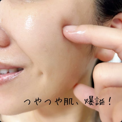 マデカッソシド エッセンシャルマスク/MEDIHEAL/シートマスク・パックを使ったクチコミ(4枚目)