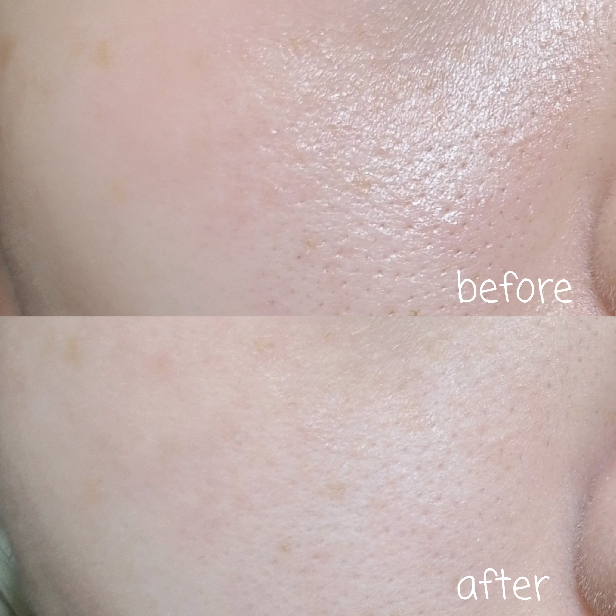 ポアカバー C/ポイントマジックPRO/化粧下地を使ったクチコミ（3枚目）