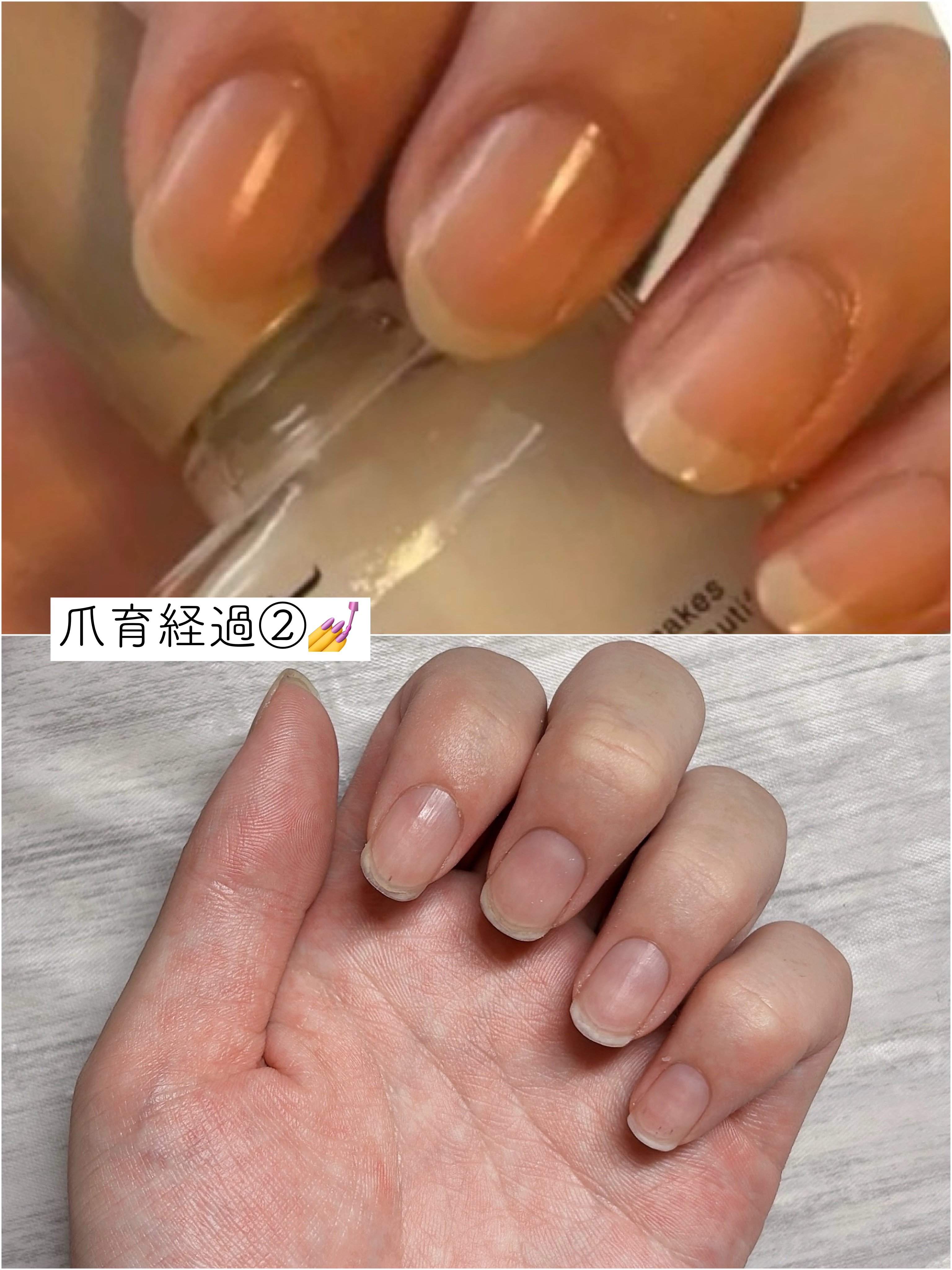 ボタニカルネイルオイル/キャンメイク/ネイルオイル・トリートメントを使ったクチコミ（1枚目）