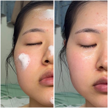 SUPER GLOW DEEP COLLAGEN BUBBLE SERUM/SKINEGO/美容液を使ったクチコミ(4枚目)